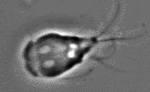 Giardia